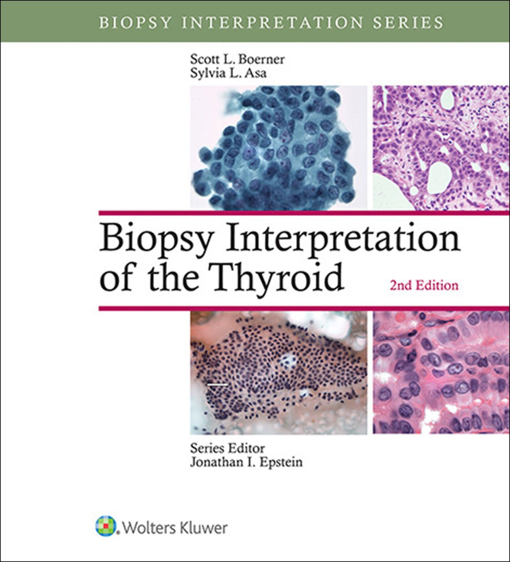 Biopsy Interpretation of the Thyroid 2nd Edition â€“ PDF/EPUB Version Downloadable