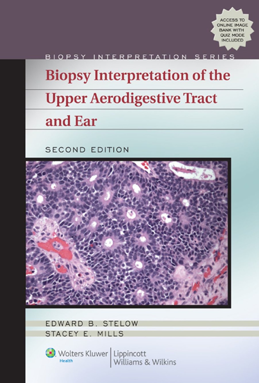 Biopsy Interpretation of the Upper Aerodigestive Tract and Ear 2nd Edition â€“ PDF/EPUB Version Downloadable