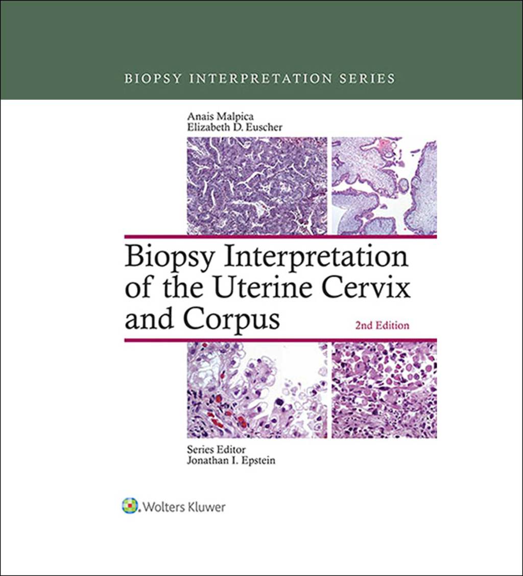 Biopsy Interpretation of the Uterine Cervix and Corpus 2nd Edition â€“ PDF/EPUB Version Downloadable