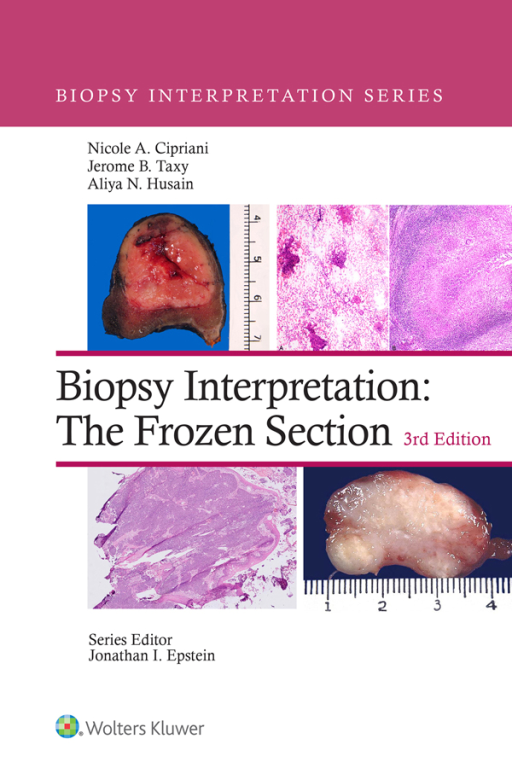 Biopsy Interpretation: The Frozen Section 3rd Edition â€“ PDF/EPUB Version Downloadable