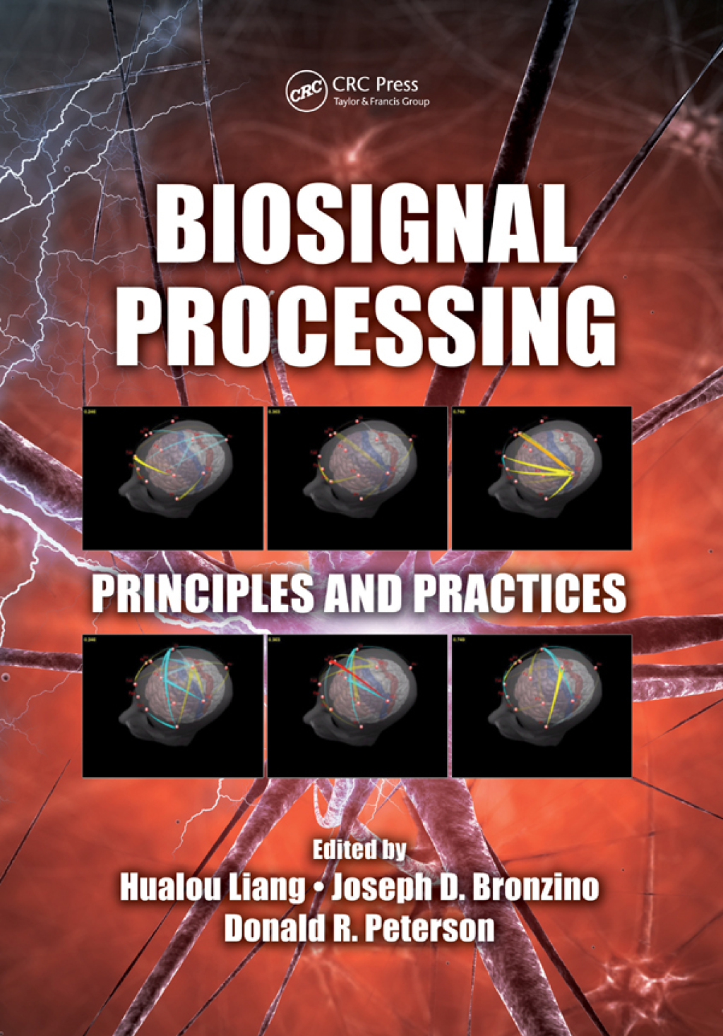 Biosignal Processing Principles and Practices 1st Edition â€“ PDF/EPUB Version Downloadable