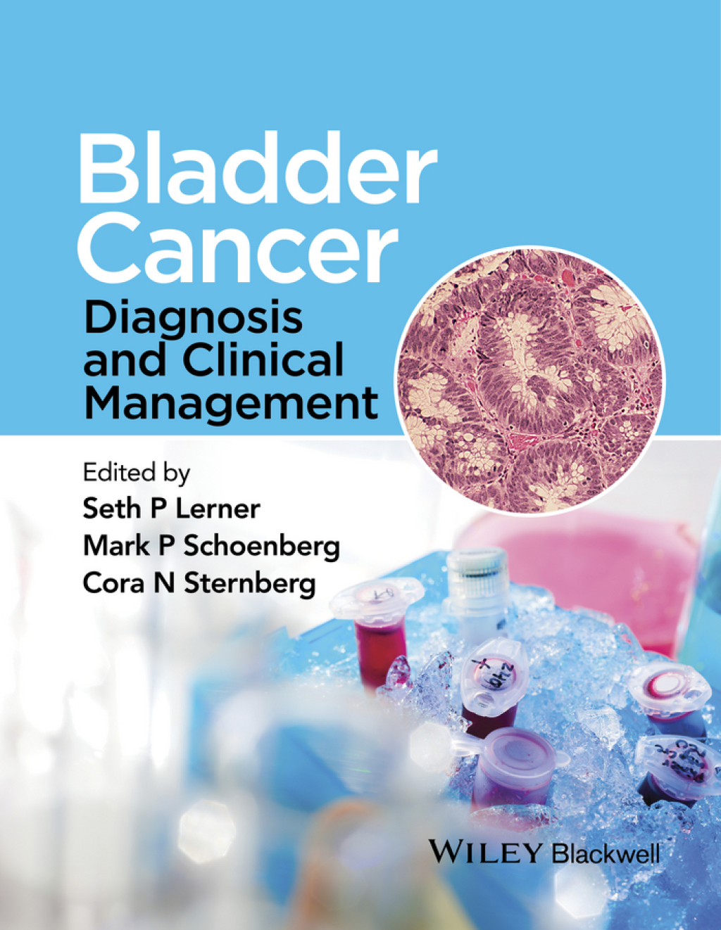Bladder Cancer Diagnosis and Clinical Management 1st Edition â€“ PDF/EPUB Version Downloadable