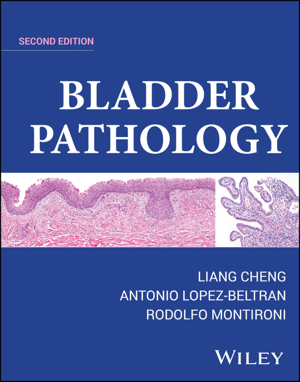 Bladder Pathology 2nd Edition â€“ PDF/EPUB Version Downloadable