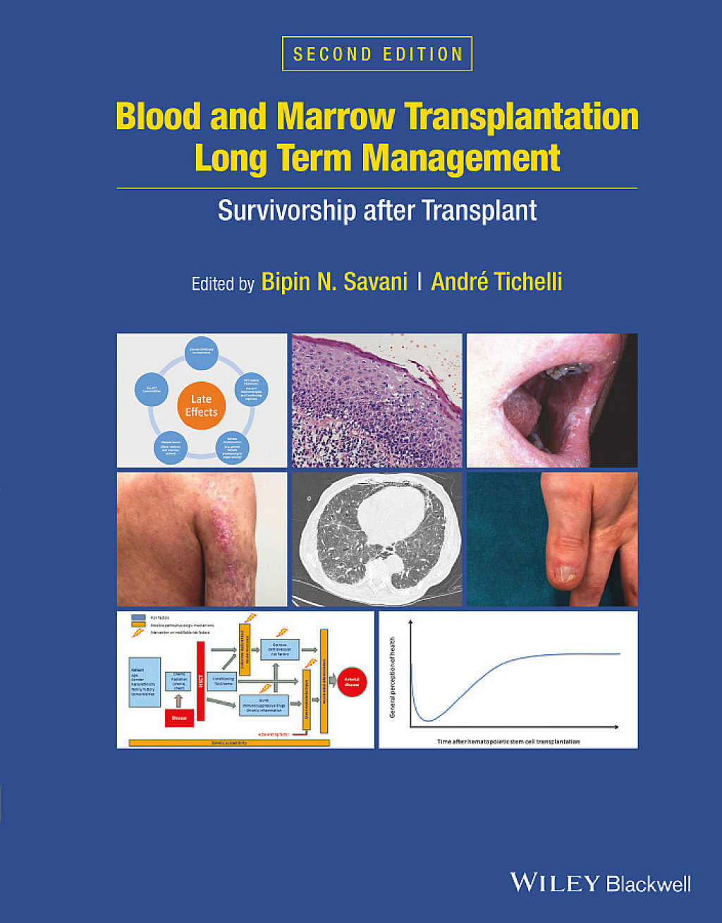 Blood and Marrow Transplantation Long Term Management Survivorship after Transplant 2nd Edition â€“ PDF/EPUB Version Downloadable
