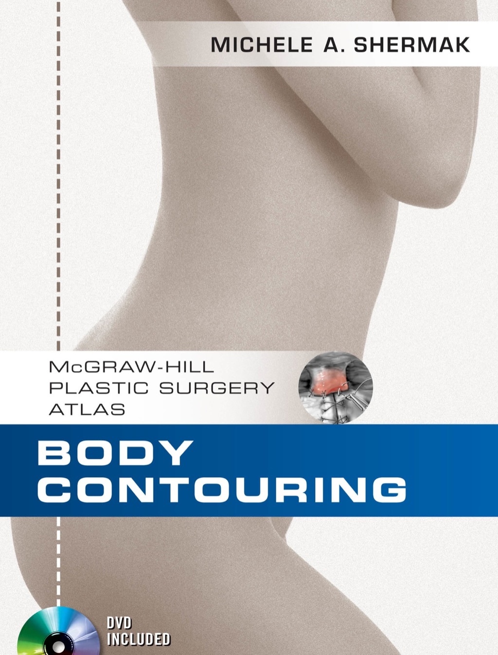 Body Contouring 1st Edition â€“ PDF/EPUB Version Downloadable