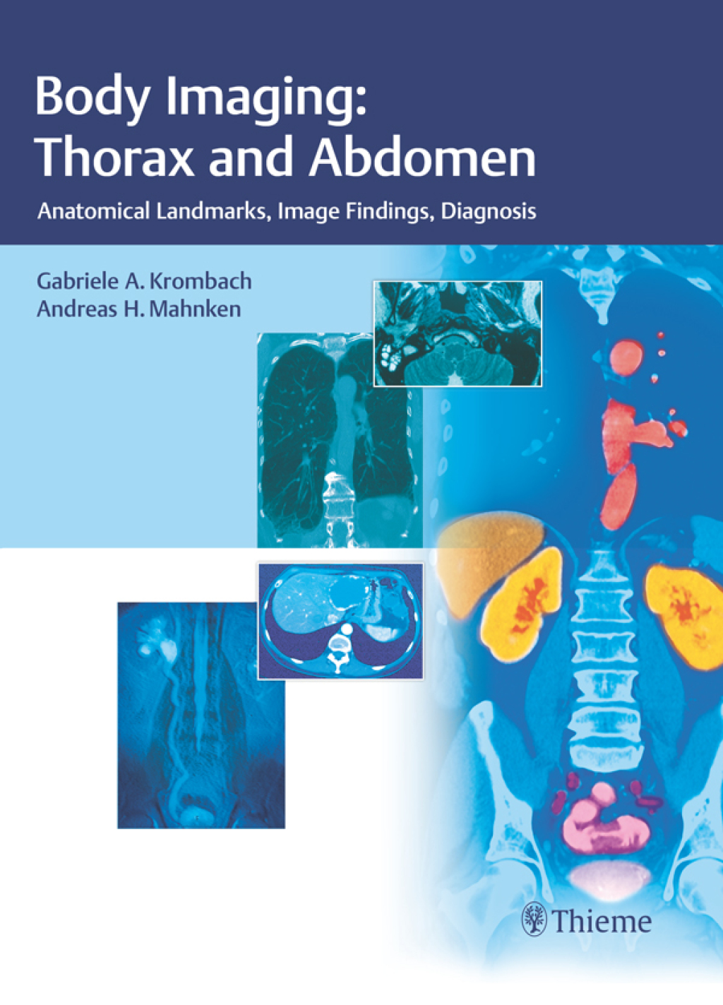 Body Imaging: Thorax and Abdomen Anatomical Landmarks, Image Findings, Diagnosis 1st Edition â€“ PDF/EPUB Version Downloadable