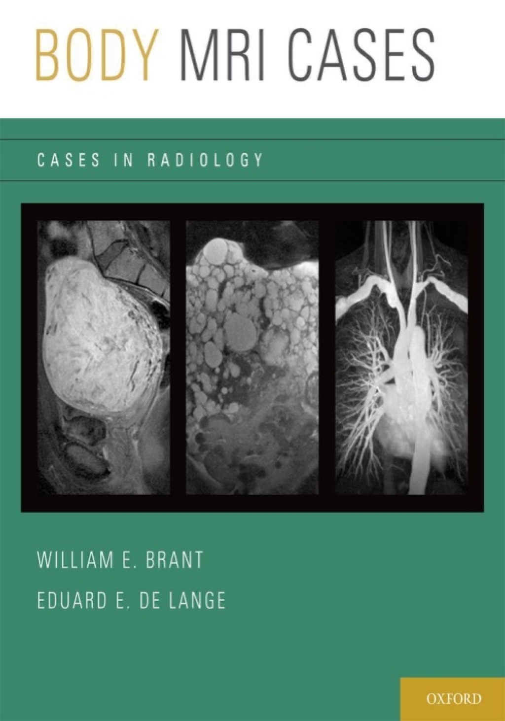 Body MRI Cases 1st Edition â€“ PDF/EPUB Version Downloadable