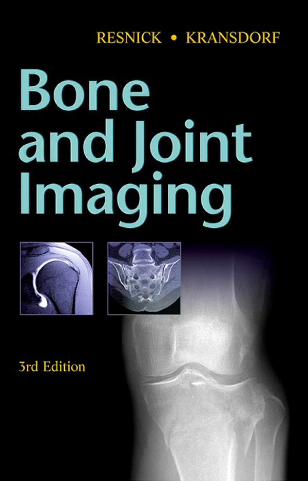 Bone and Joint Imaging 3rd Edition â€“ PDF/EPUB Version Downloadable
