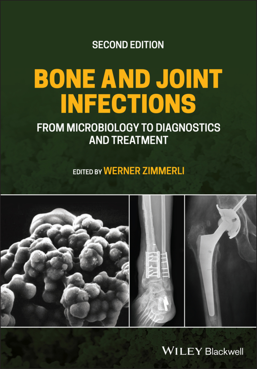 Bone and Joint Infections From Microbiology to Diagnostics and Treatment 2nd Edition â€“ PDF/EPUB Version Downloadable