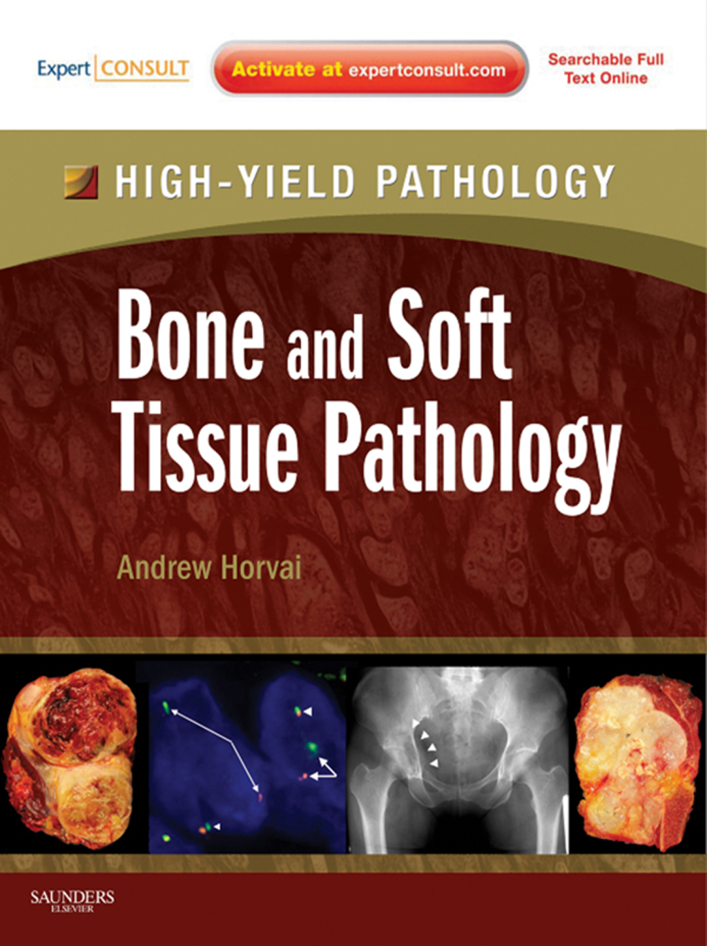 Bone and Soft Tissue Pathology 1st Edition â€“ PDF/EPUB Version Downloadable