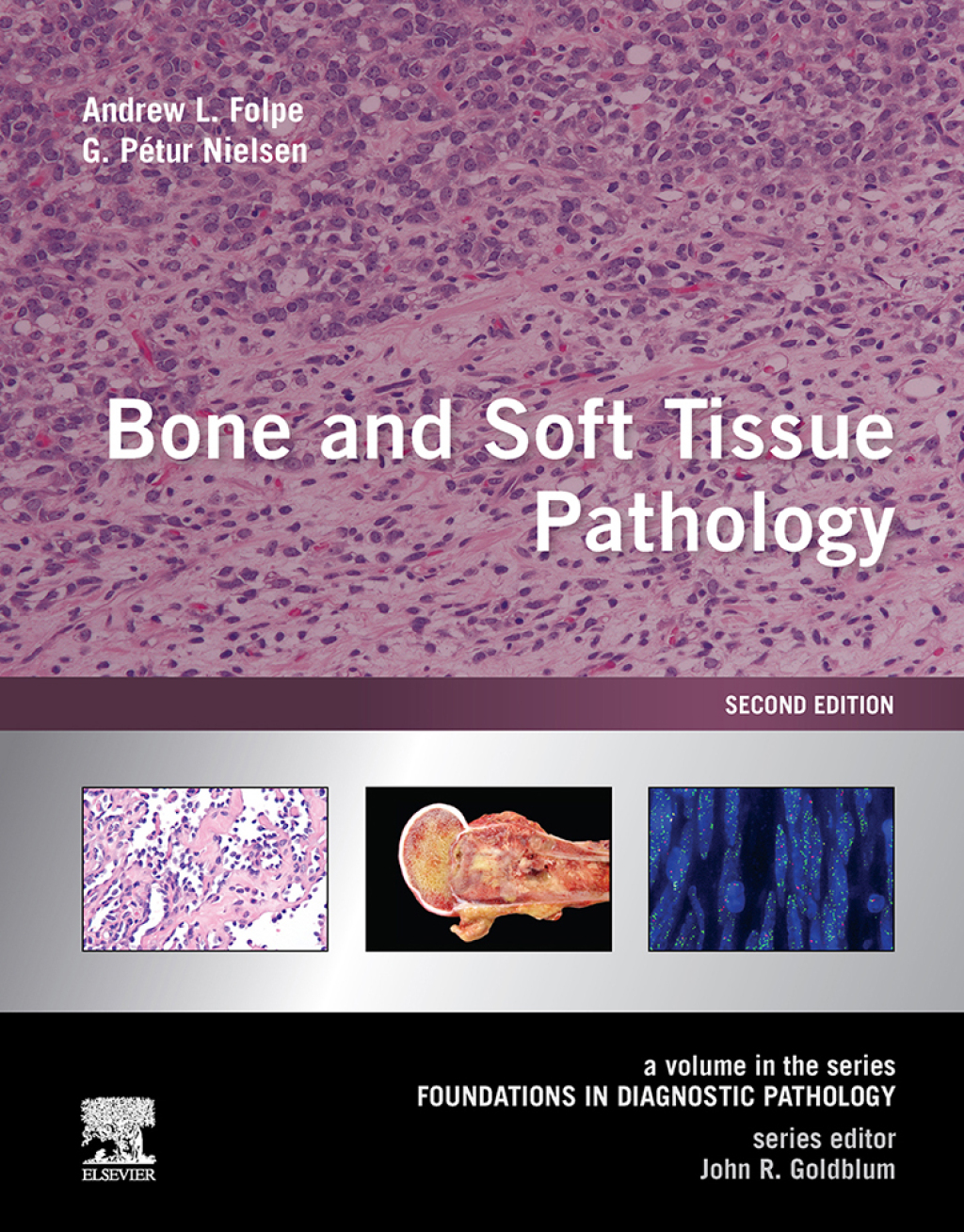 Bone and Soft Tissue Pathology E-Book A Volume in the Series: Foundations in Diagnostic Pathology 2nd Edition â€“ PDF/EPUB Version Downloadable
