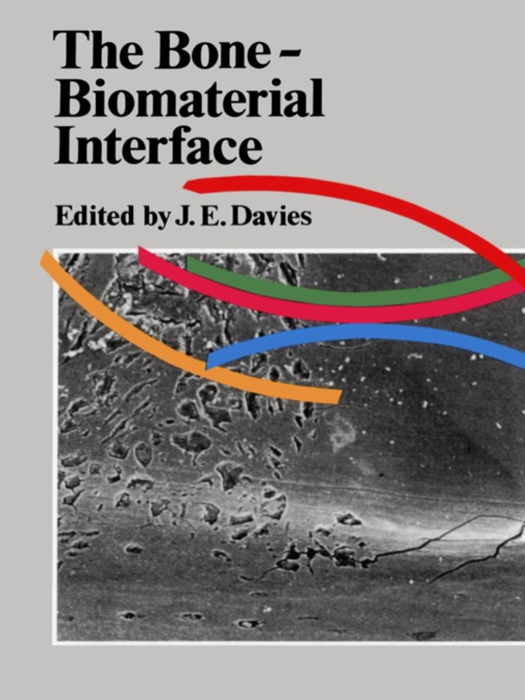 Bone-Bio Material Interface 1st Edition â€“ PDF/EPUB Version Downloadable