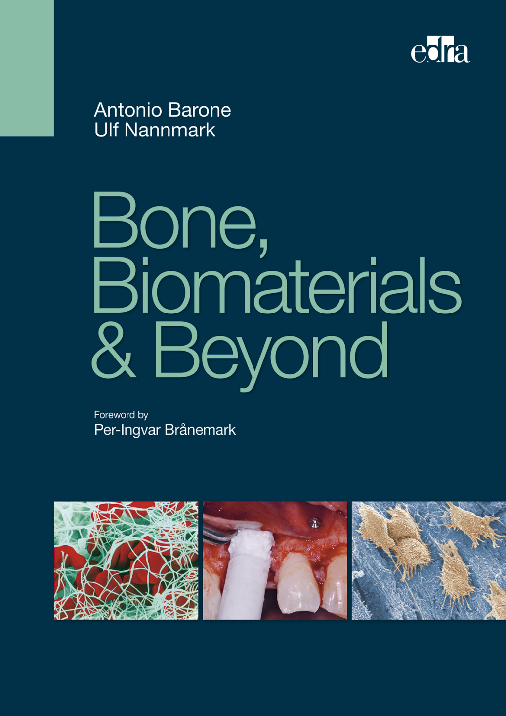 Bone, Biomaterials & Beyond 1st Edition â€“ PDF/EPUB Version Downloadable