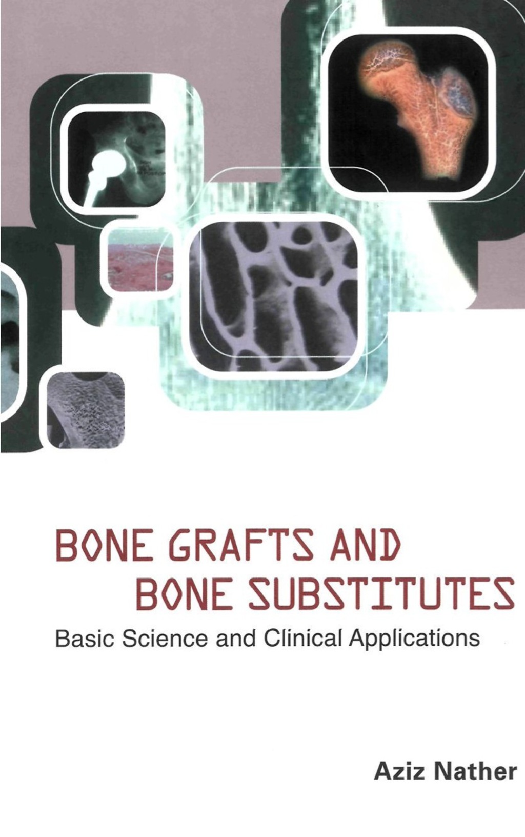 Bone Grafts And Bone Substitutes: Basic Science And Clinical Applications â€“ PDF/EPUB Version Downloadable