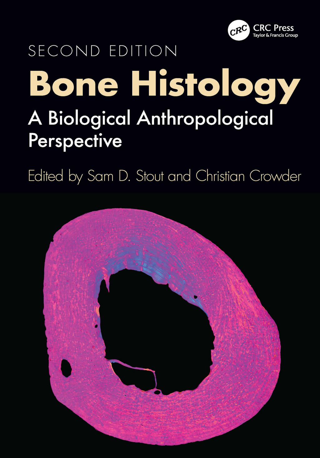 Bone Histology A Biological Anthropological Perspective 2nd Edition â€“ PDF/EPUB Version Downloadable