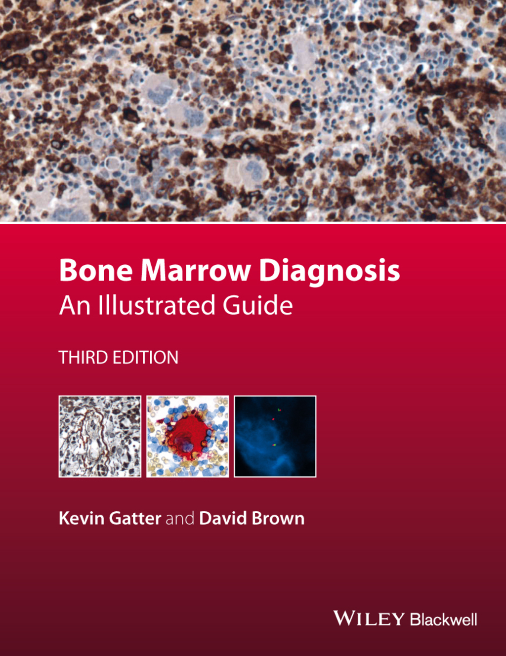 Bone Marrow Diagnosis: An Illustrated Guide 3rd Edition â€“ PDF/EPUB Version Downloadable