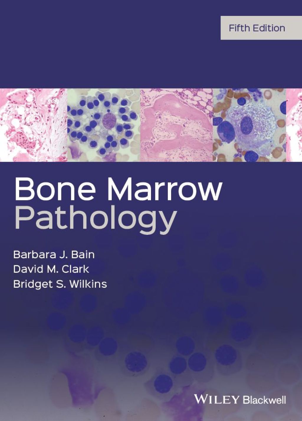 Bone Marrow Pathology 5th Edition â€“ PDF/EPUB Version Downloadable