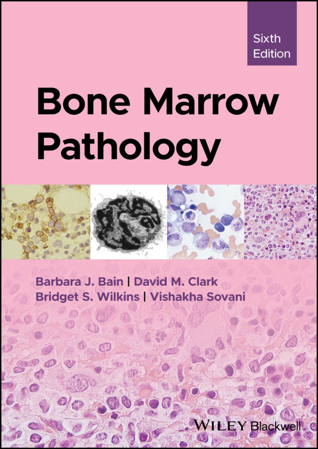 Bone Marrow Pathology 6th Edition â€“ PDF/EPUB Version Downloadable
