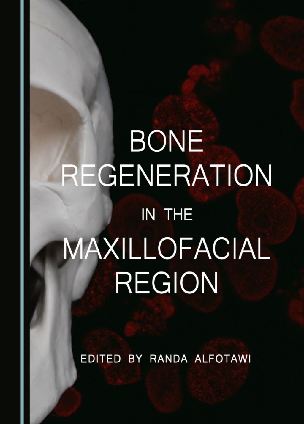 Bone Regeneration in the Maxillofacial Region 1st Edition â€“ PDF/EPUB Version Downloadable