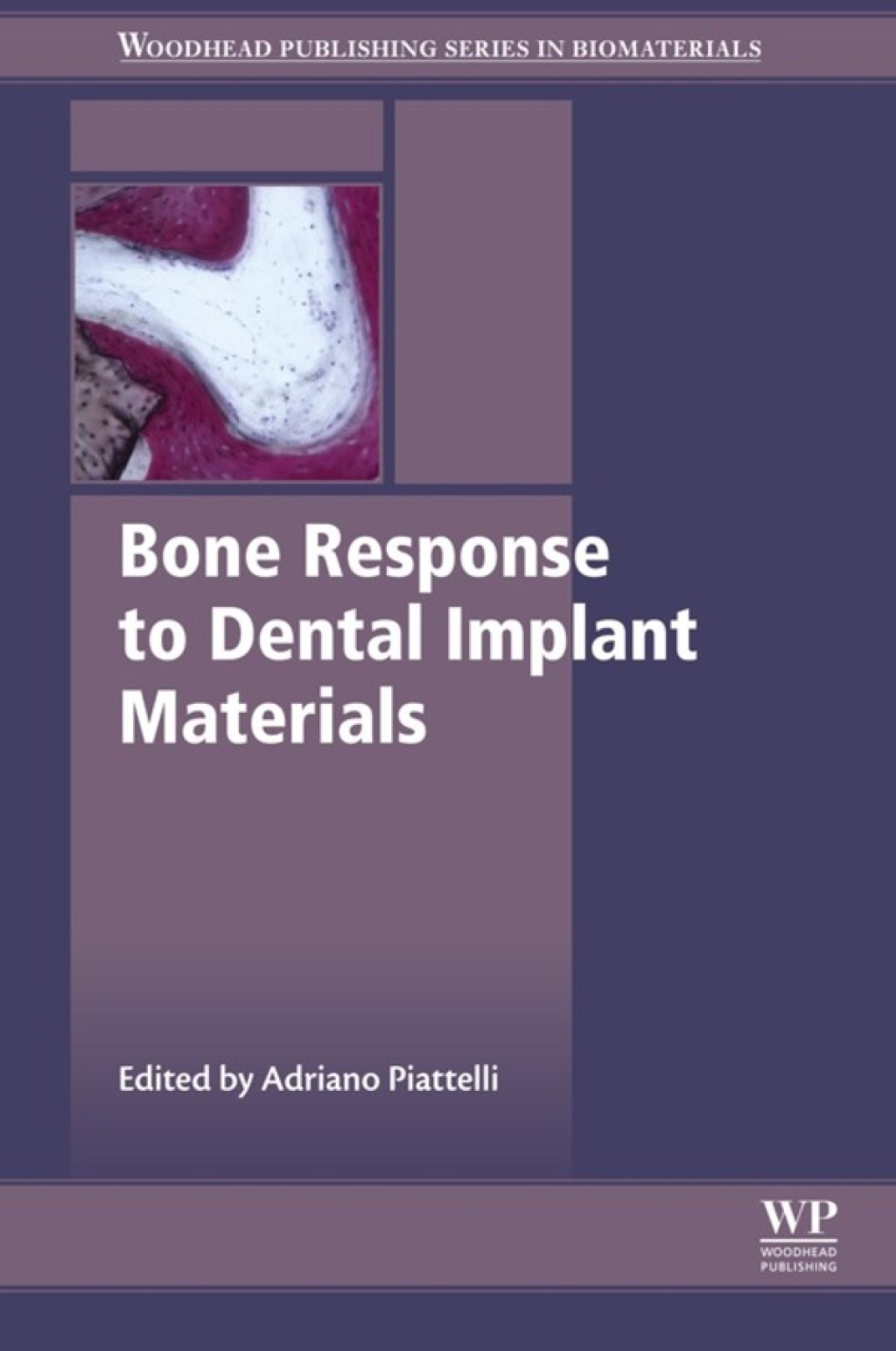 Bone Response to Dental Implant Materials â€“ PDF/EPUB Version Downloadable