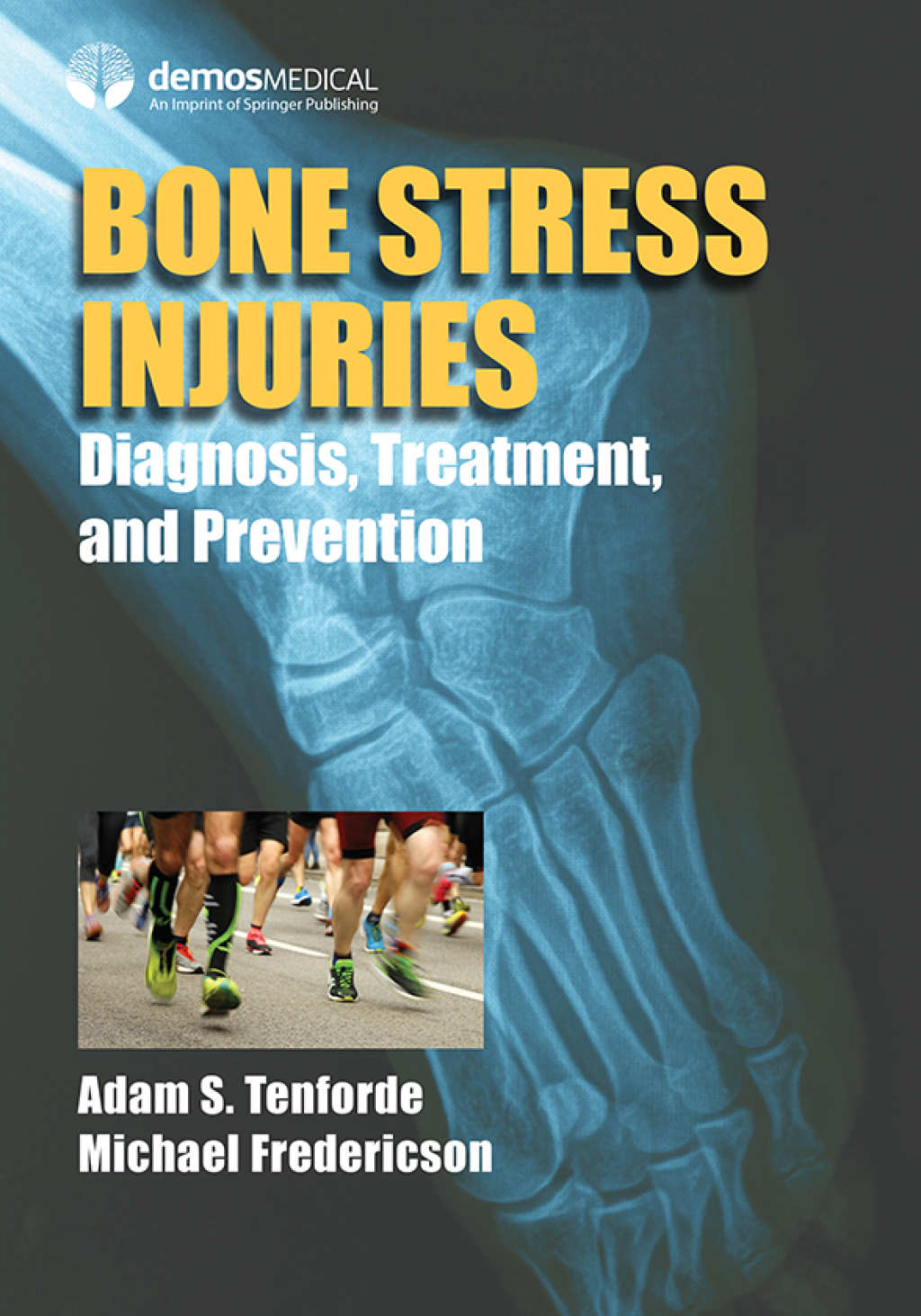 Bone Stress Injuries Diagnosis, Treatment, and Prevention 1st Edition â€“ PDF/EPUB Version Downloadable