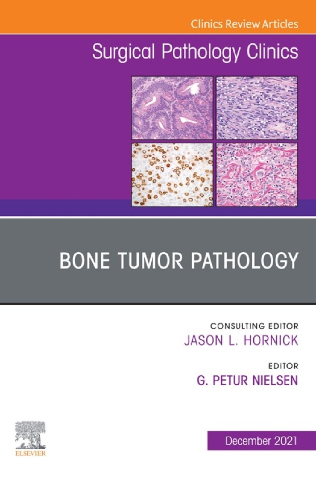 Bone Tumor Pathology, An Issue of Surgical Pathology Clinics  â€“ PDF/EPUB Version Downloadable
