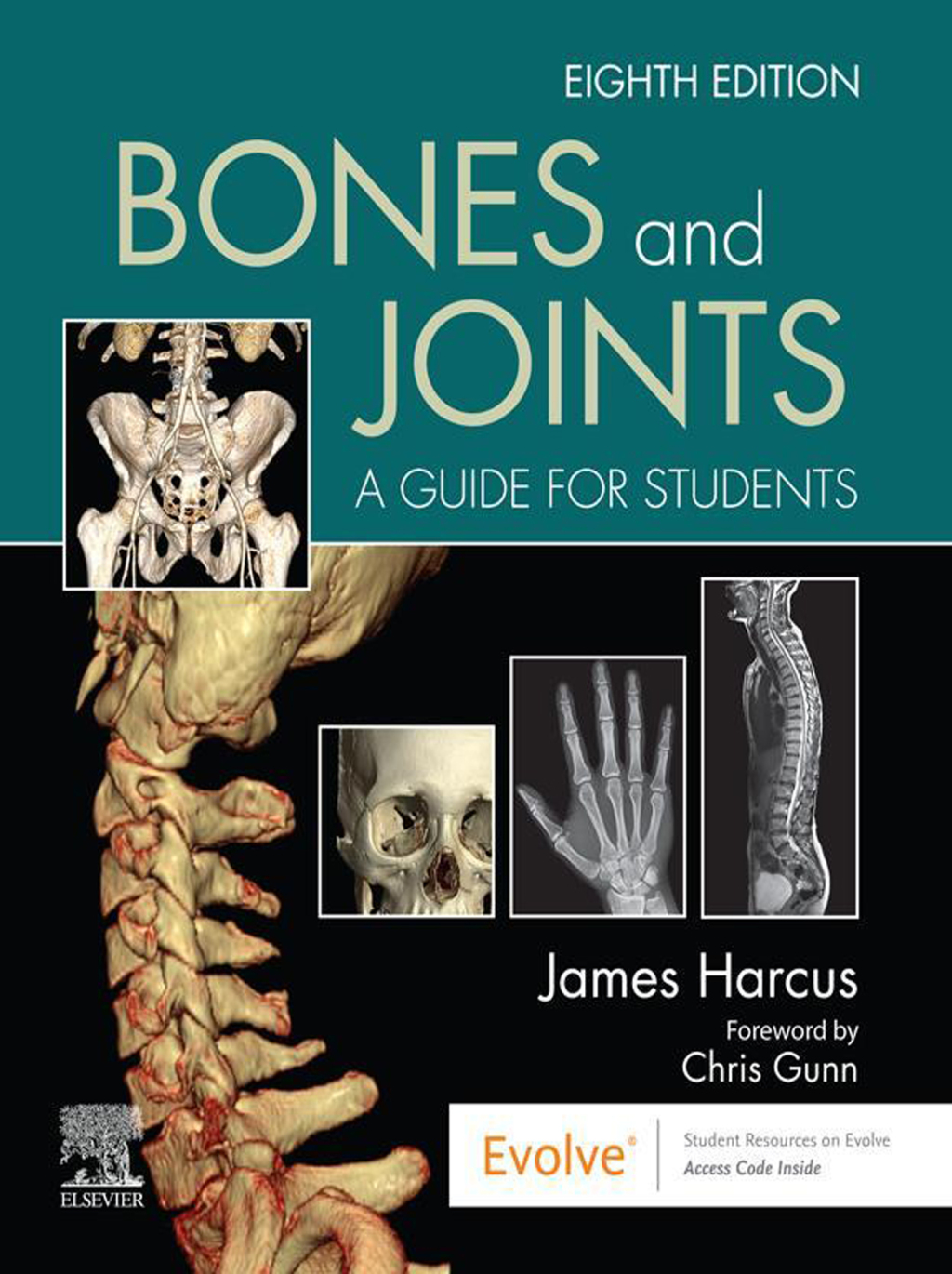 Bones and Joints 8th Edition â€“ PDF/EPUB Version Downloadable