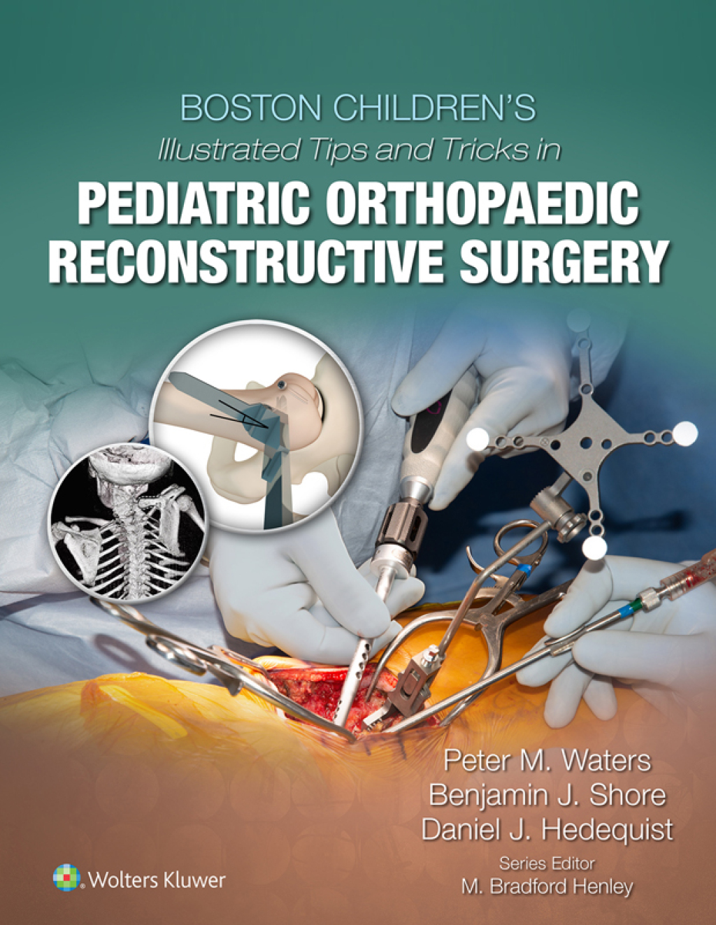 Boston Children's Illustrated Tips and Tricks in Pediatric Orthopaedic Reconstructive Surgery â€“ PDF/EPUB Version Downloadable