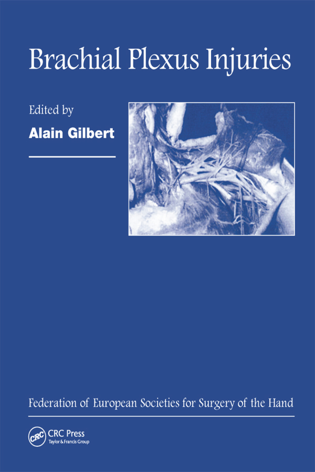 Brachial Plexus Injuries Published in Association with the Federation Societies for Surgery of the Hand 1st Edition â€“ PDF/EPUB Version Downloadable