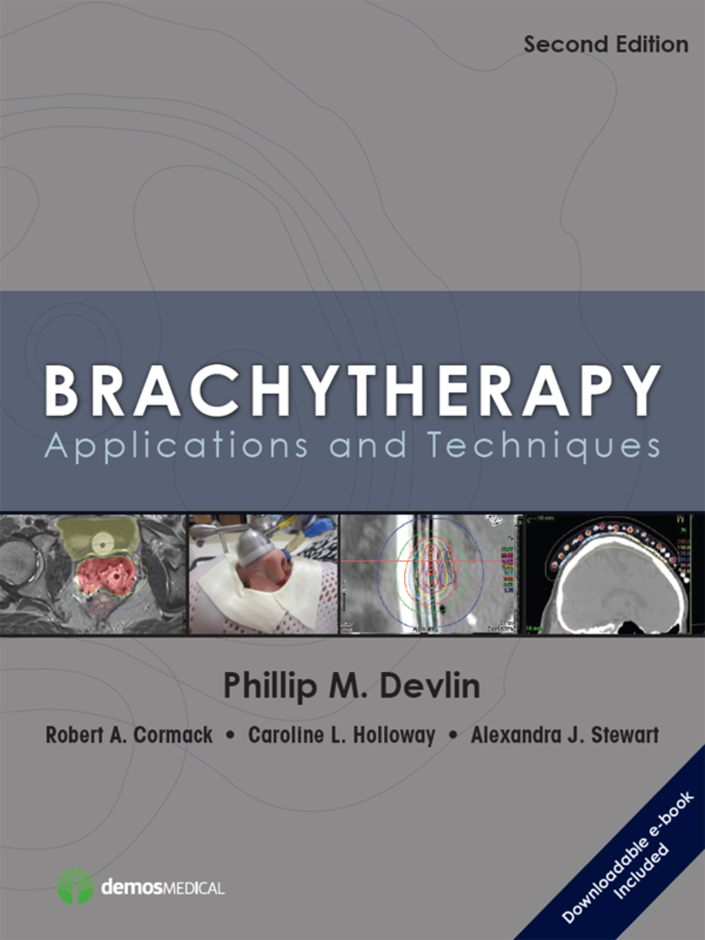 Brachytherapy, Second Edition Applications and Techniques 2nd Edition â€“ PDF/EPUB Version Downloadable