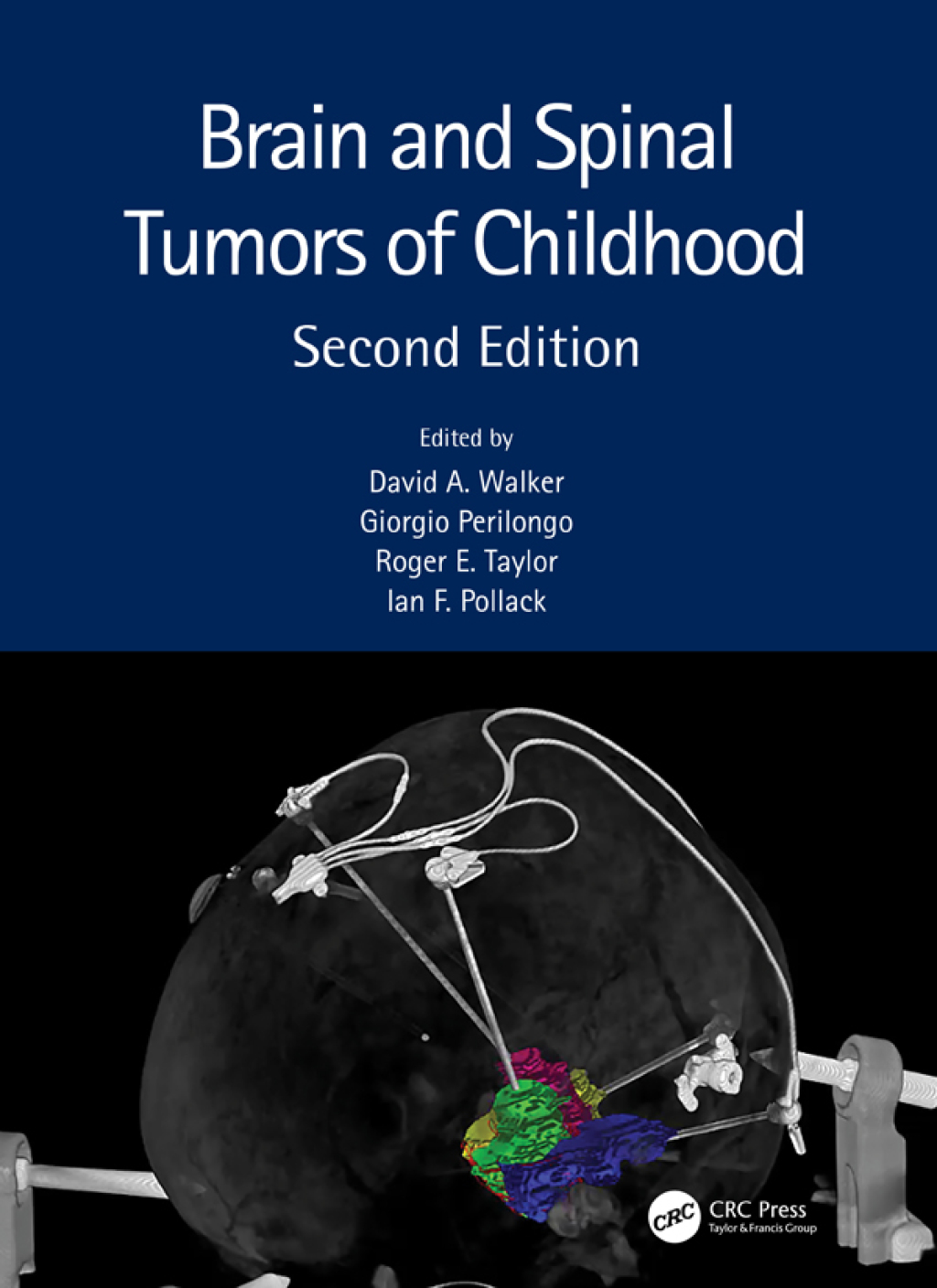 Brain and Spinal Tumors of Childhood 2nd Edition â€“ PDF/EPUB Version Downloadable
