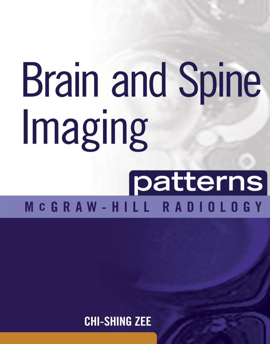Brain and Spine Imaging Patterns 1st Edition â€“ PDF/EPUB Version Downloadable