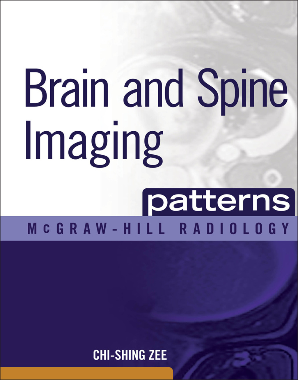 Brain and Spine Imaging Patterns BRAIN & SPINE IMAGING (EBOOK) 1st Edition â€“ PDF/EPUB Version Downloadable