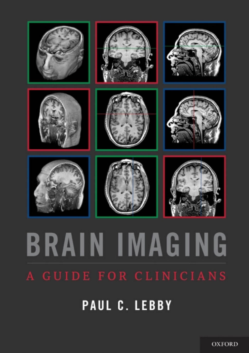 Brain Imaging A Guide for Clinicians â€“ PDF/EPUB Version Downloadable