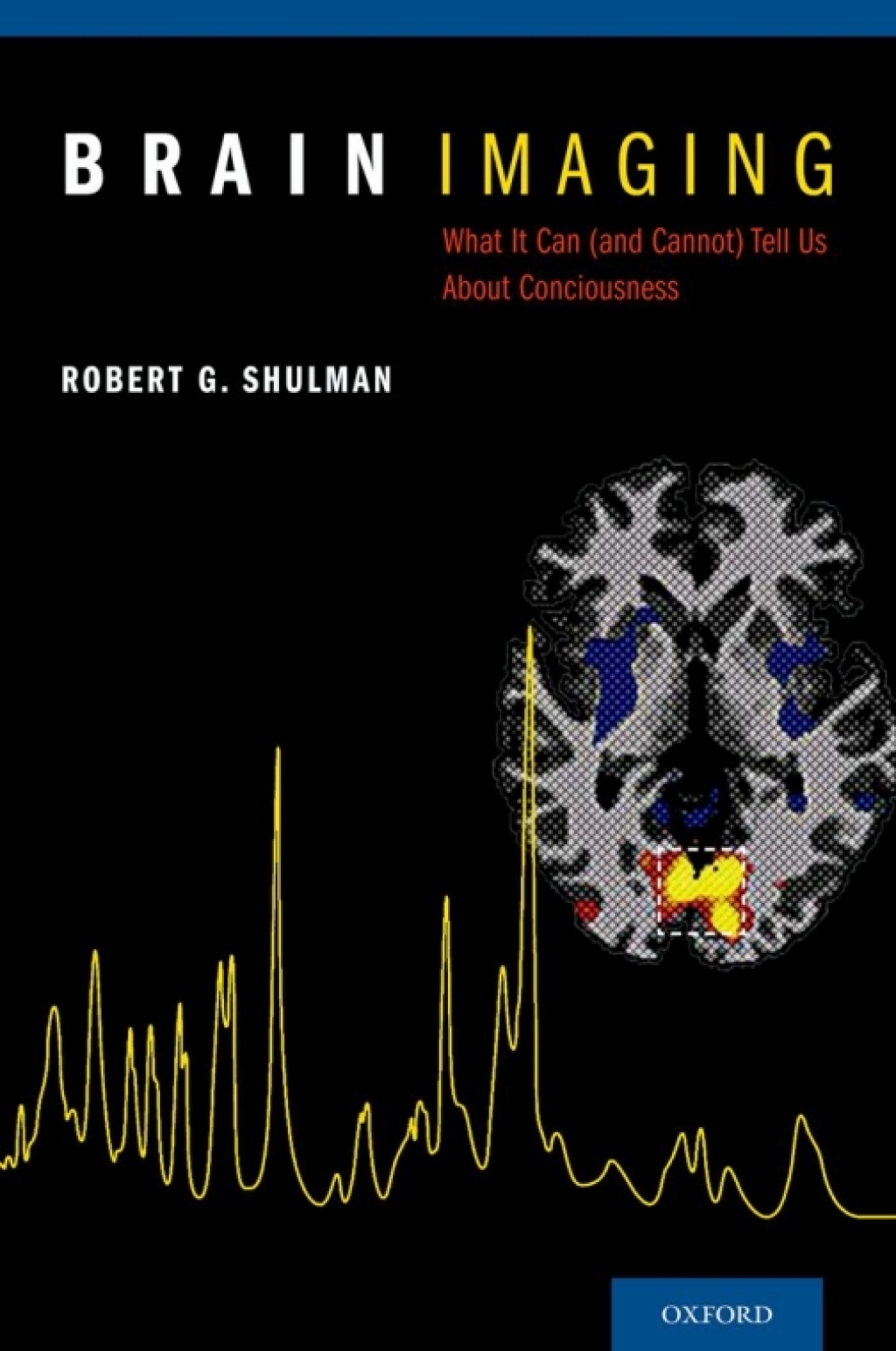 Brain Imaging What it Can (and Cannot) Tell Us About Consciousness  â€“ PDF/EPUB Version Downloadable
