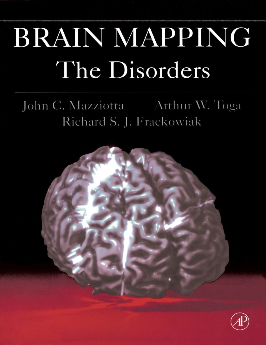 Brain Mapping: The Disorders: The Disorders â€“ PDF/EPUB Version ...