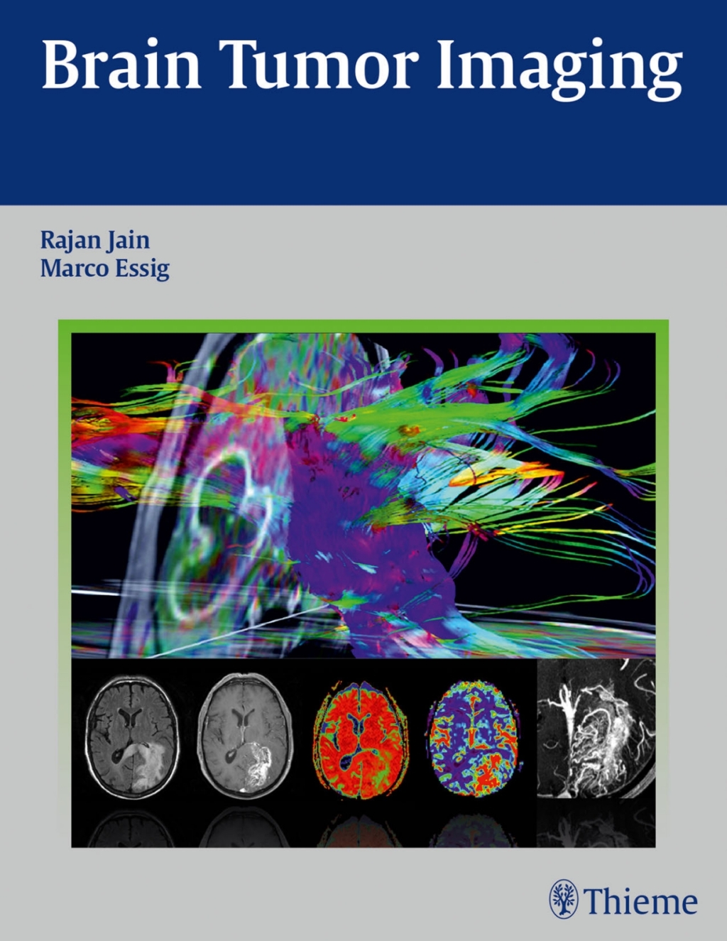 Brain Tumor Imaging 1st Edition – PDF/EPUB Version Downloadable Brain Tumor Imaging 1st Edition – PDF/EPUB Version Downloadable - Image 1