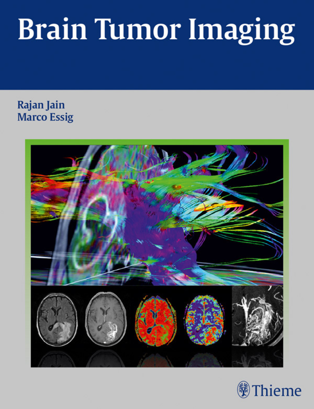 Brain Tumor Imaging 1st Edition â€“ PDF/EPUB Version Downloadable