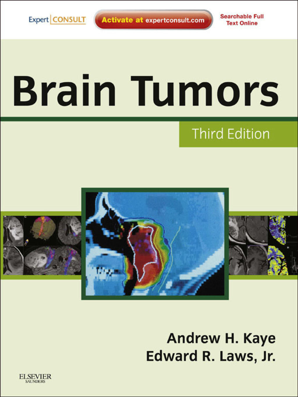 Brain Tumors - Electronic 3rd Edition â€“ PDF/EPUB Version Downloadable