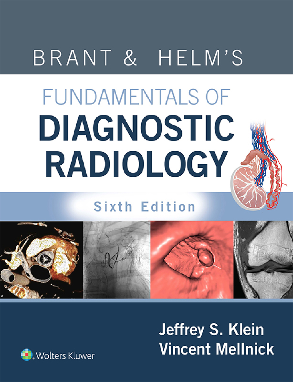 Brant & Helm's Fundamentals of Diagnostic Radiology 6th Edition â€“ PDF/EPUB Version Downloadable
