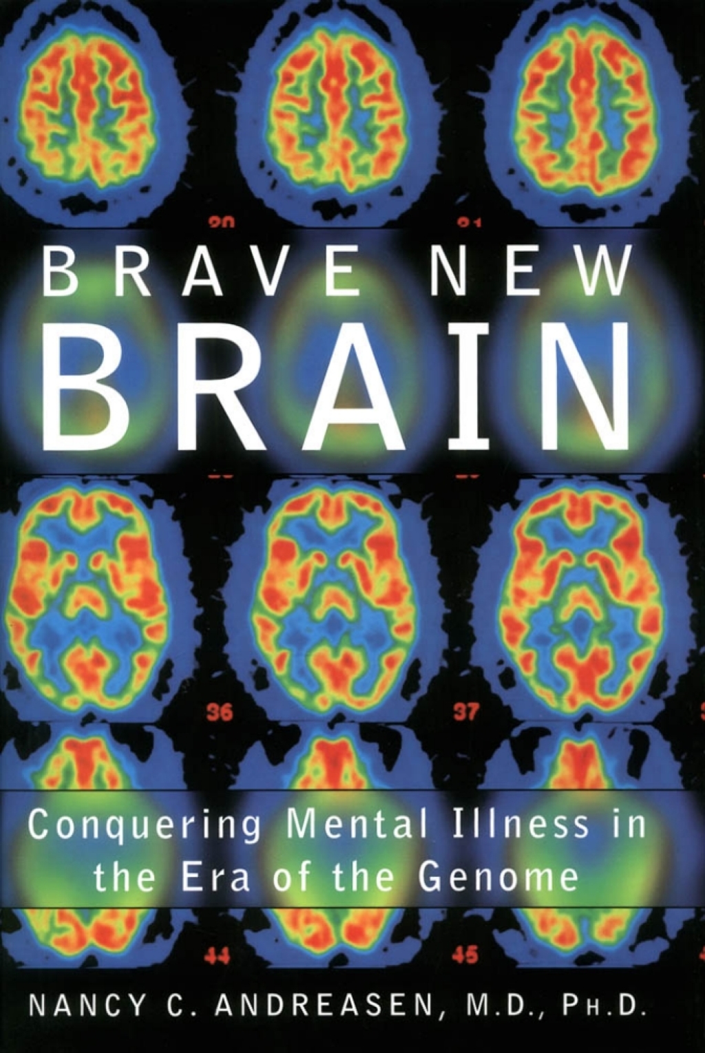Brave New Brain Conquering Mental Illness in the Era of the Genome - (PDF/EPUB Version)