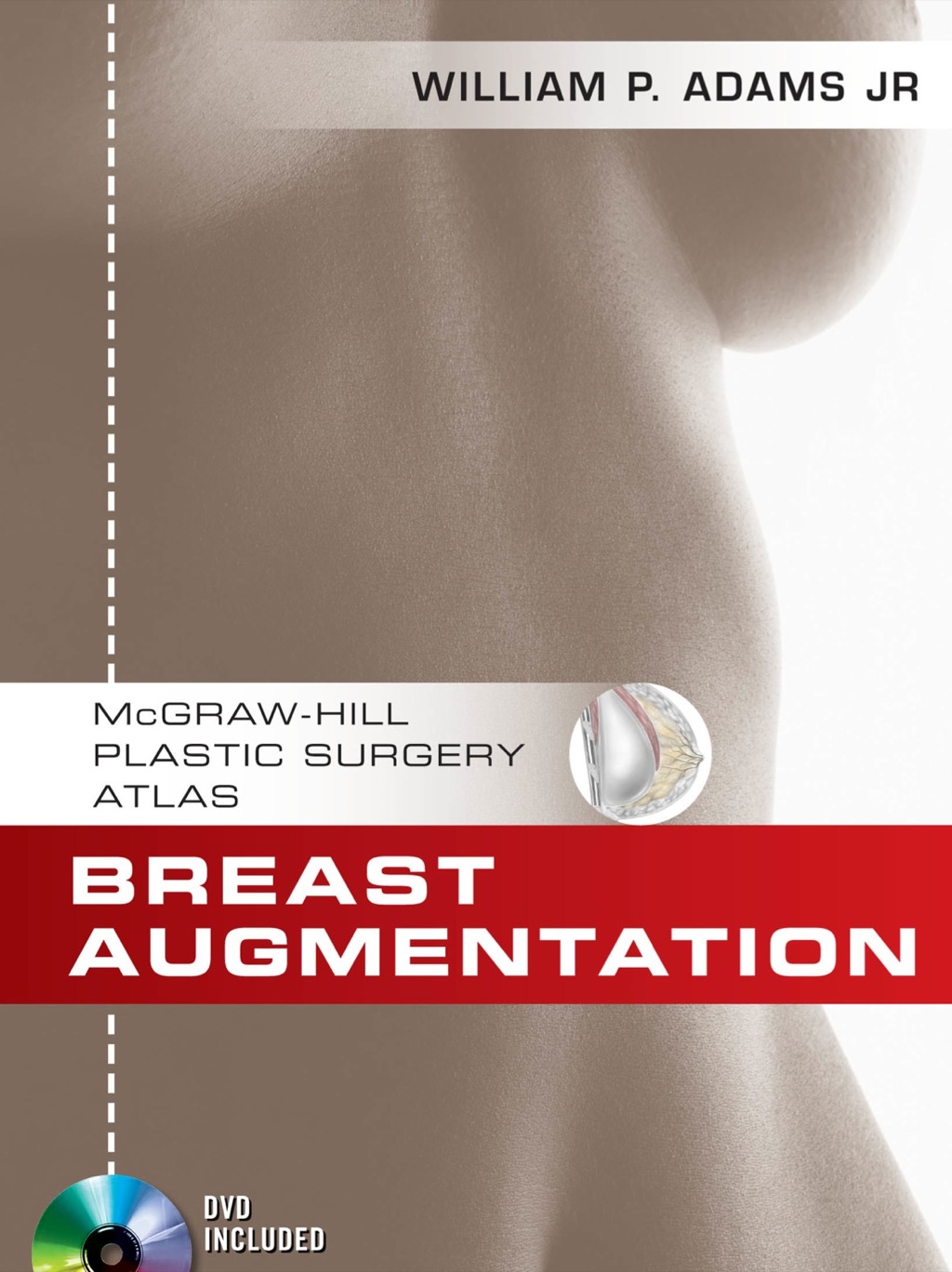 Breast Augmentation 1st Edition â€“ PDF/EPUB Version Downloadable