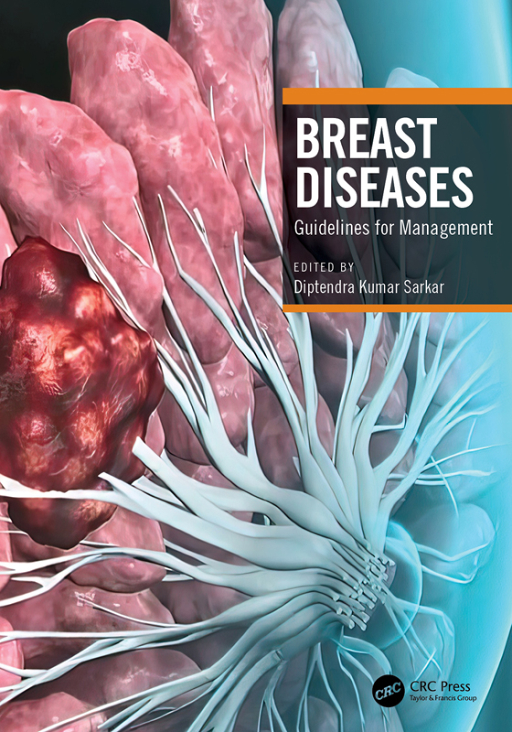 Breast Diseases Guidelines for Management 1st Edition â€“ PDF/EPUB Version Downloadable