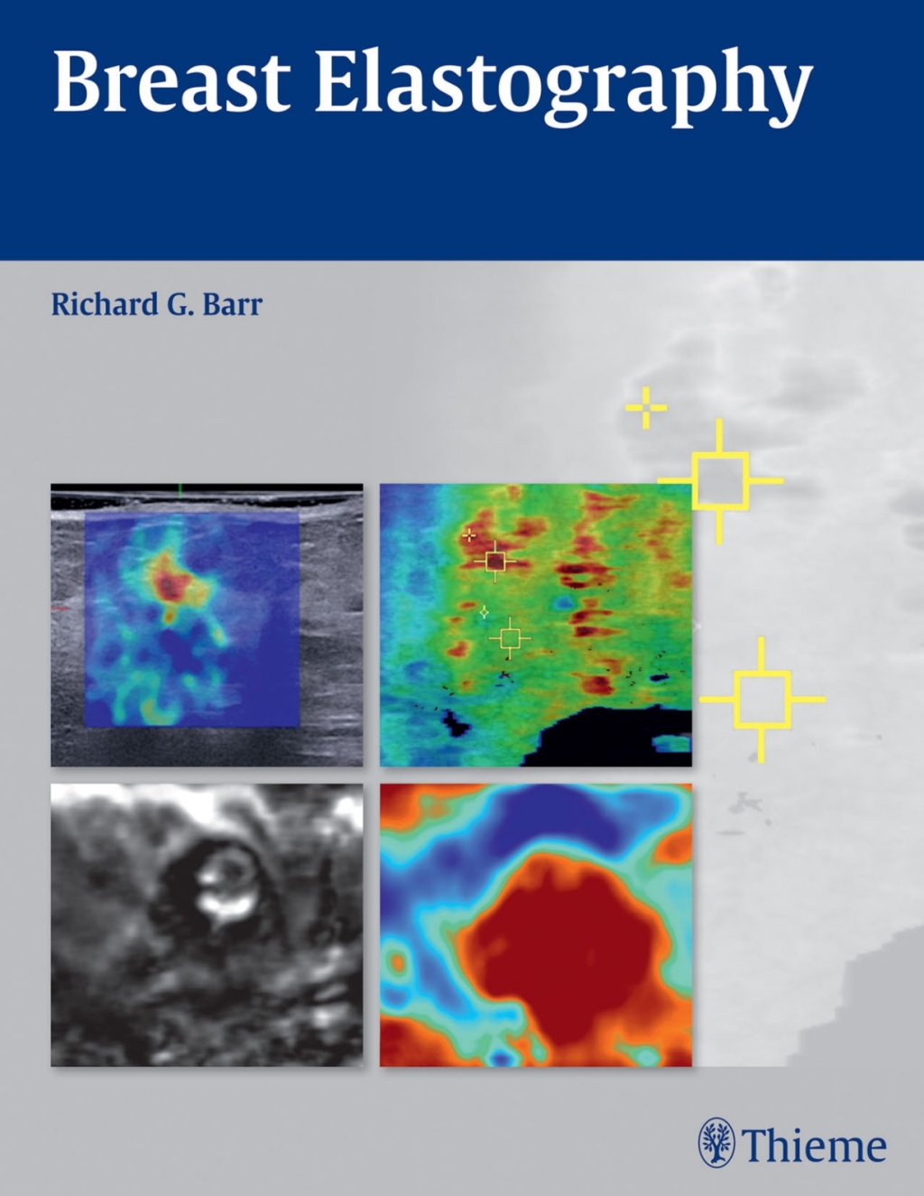 Breast Elastography 1st Edition â€“ PDF/EPUB Version Downloadable