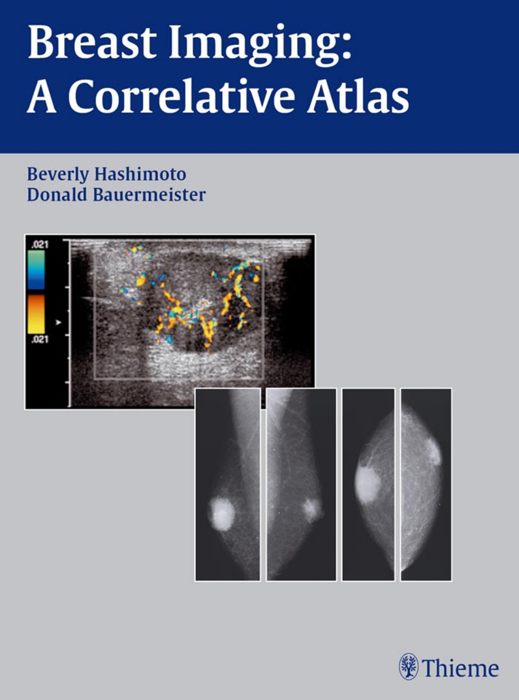 Breast Imaging A Correlative Atlas 1st Edition â€“ PDF/EPUB Version Downloadable