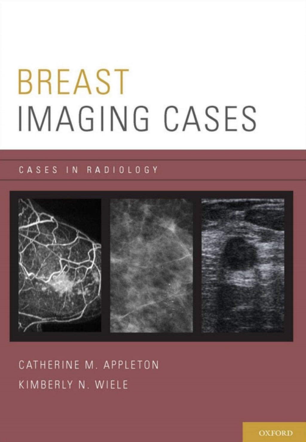 Breast Imaging Cases  â€“ PDF/EPUB Version Downloadable