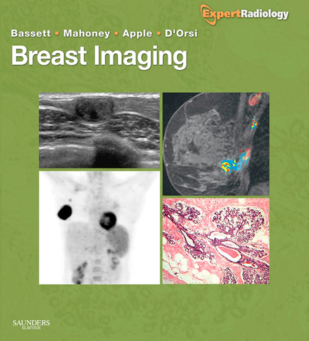 Breast Imaging: Expert Radiology Series 1st Edition â€“ PDF/EPUB Version Downloadable