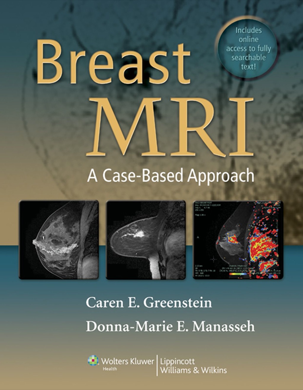 Breast MRI â€“ PDF/EPUB Version Downloadable