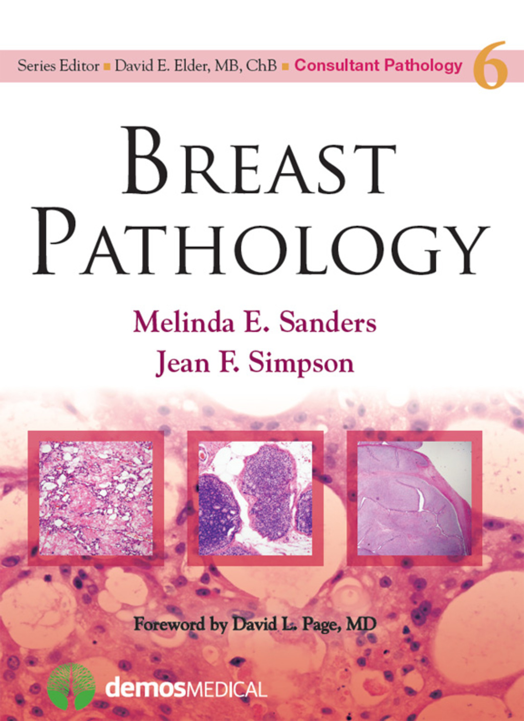 Breast Pathology 1st Edition â€“ PDF/EPUB Version Downloadable