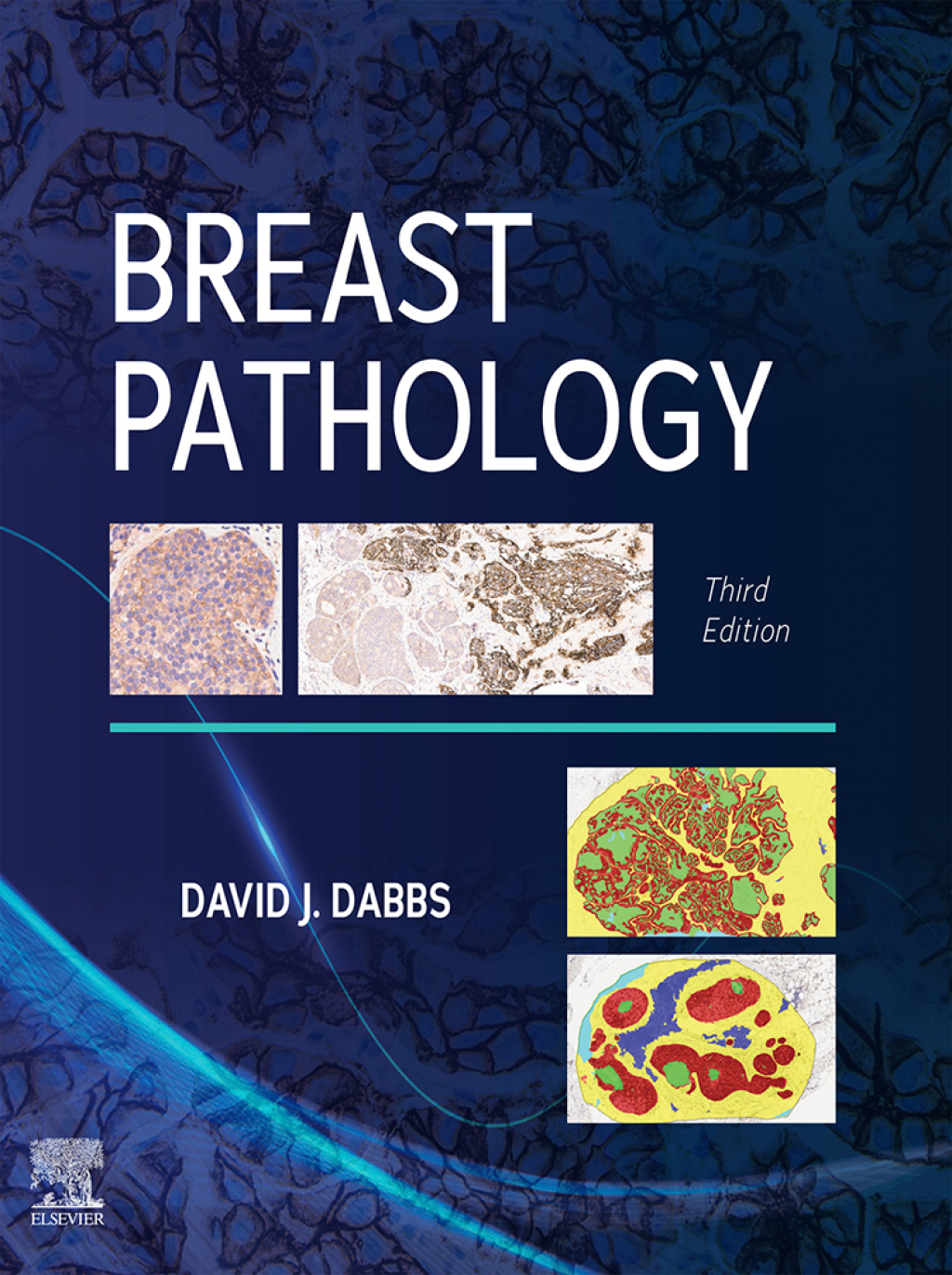Breast Pathology 3rd Edition â€“ PDF/EPUB Version Downloadable